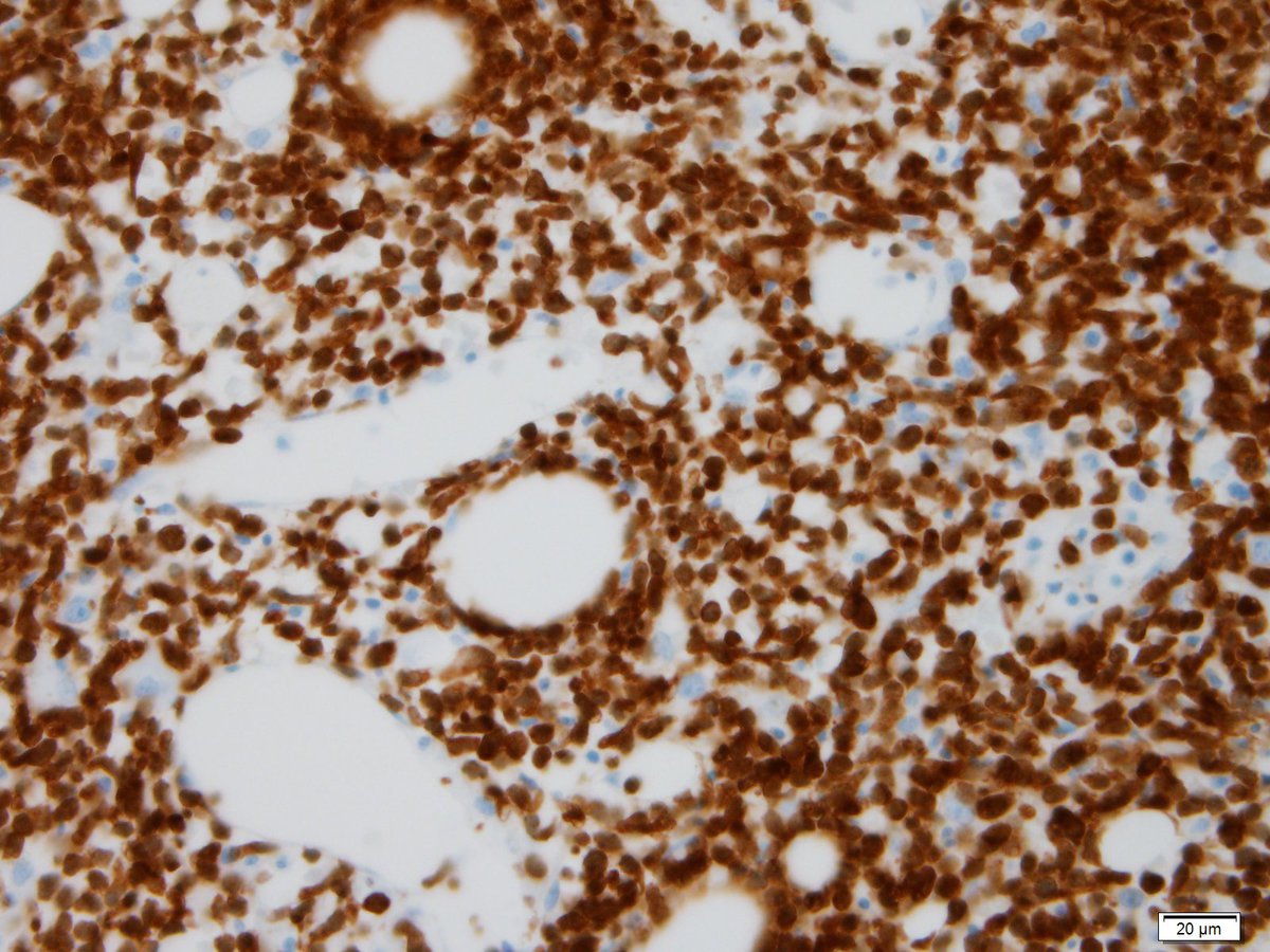 Figure 17 TCL1